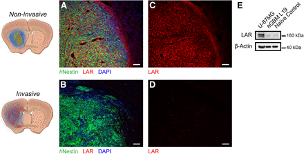 Chondroitin Sulfate Proteoglycans Potently Inhibit Invasion and Serve ...