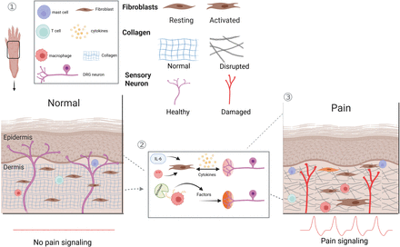 Not Just Neurons: Pain Is Orchestrated in Partnership with Many Non ...
