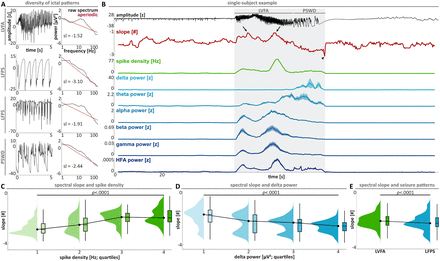 Aperiodic Activity Reflects Pathologic Waveform Shapes in Focal ...