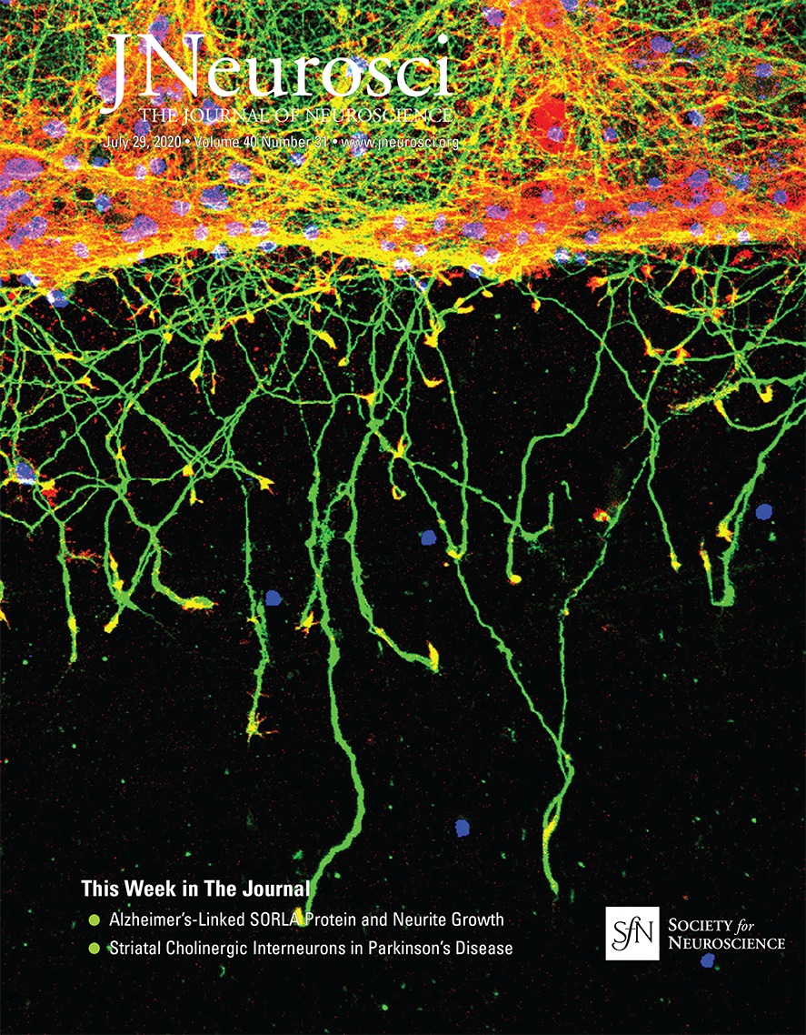 Complex Movement Control in a Rat Model of Parkinsonian Falls Bidirectional Control by Striatal Cholinergic Interneurons Journal of Neuroscience pic pic