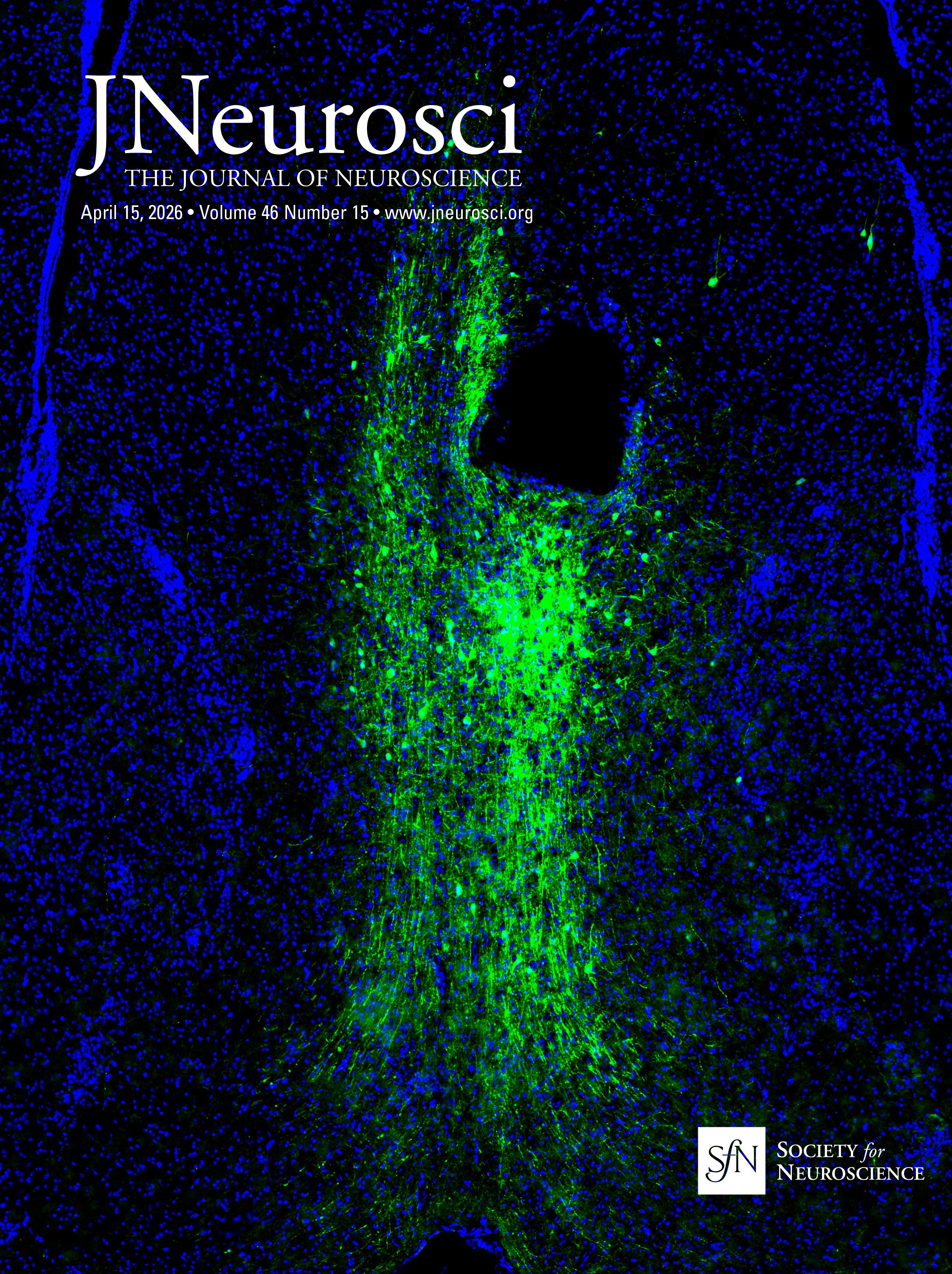 Suppression of In Vitro Epileptiform Activity by GABA Transaminase