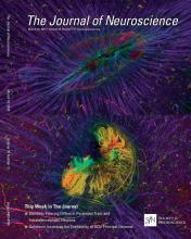 Emergence of Complex Wave Patterns in Primate Cerebral Cortex